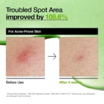 سرم تسکین دهنده و ضدالتهاب آزلائیک اسید و هیالورون آنوا Anua مدل Redness Soothing Serum(30 میل) - Image 3