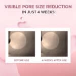 سرم (آمپول) کوچک کننده منافذ سنتلا SKIN1004 مدل Poremizing Fresh Ampoule(100 میل) - Image 5