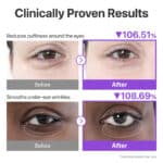 پک 5 عددی پچ زیر چشم ضد چروک و روشن کننده نامبوزین Numbuzin مدل No.9 NAD+ Collagen Under Eye Patches - Image 3