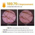 اسپری لایه‌ بردار بدن و پا دکتر ملاکسین Dr.Melaxin حاوی کوجیک اسید و زردچوبه مدل Peel Shot Exfoliating Kojic Acid Turmeric Spray (200 میل) - تصویر 3